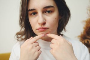 Foods That Cause Acne Flare-Ups: 5 Proven Products That Work (2026)