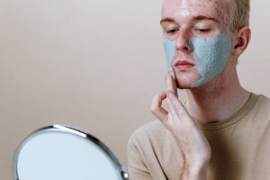 Why You Get Acne on Your Chin & Jawline (The Real Causes + Fix)